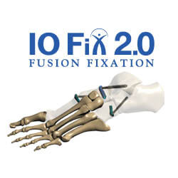 io-fix-2prod