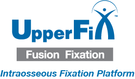 UpperFix Fusion Fixation