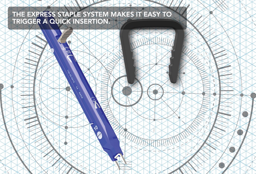 Sized for All Foot and Ankle Indications EXPRESS Staple System