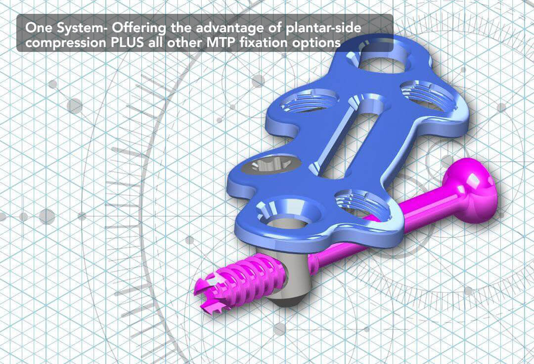 Plantarfix deals