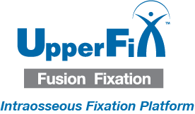 Upper FiX