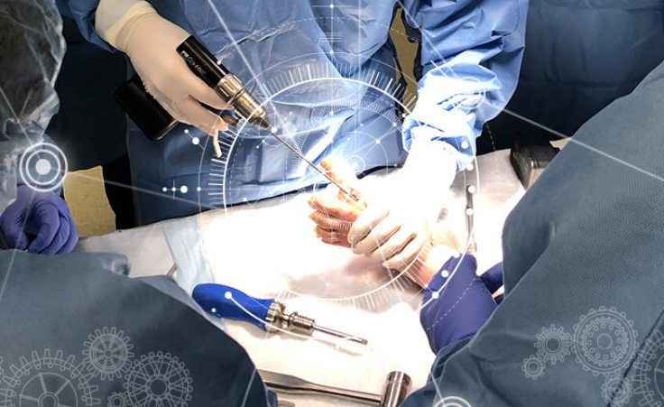 Icd-10-cm Code For Prosthetic Arm Training