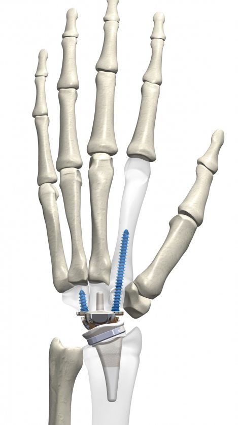 kinematx-hand kinematx-hand